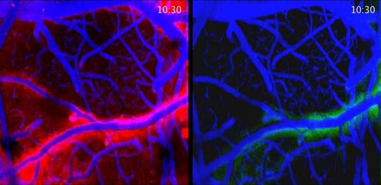 Cerebrospinal Fluid Activity Asleep vs. Awake
