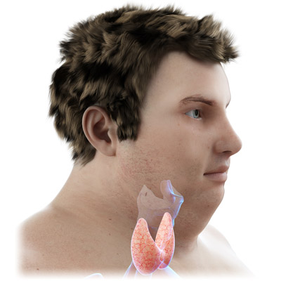 Man with Underactive Thyroid